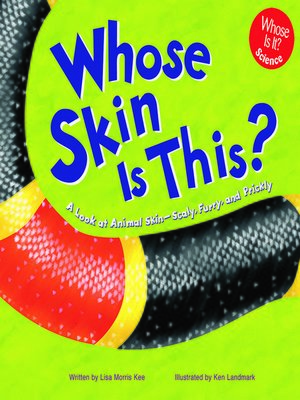 cover image of Whose Skin Is This?